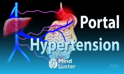 Portal Hypertension Animation