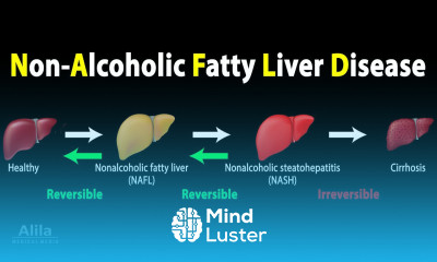 Nonalcoholic Fatty Liver Disease NAFLD Animation
