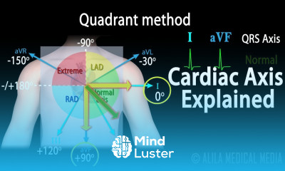 Cardiac Axis Interpretation Animation