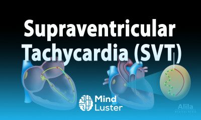 Supraventricular Tachycardia SVT PSVT Animation