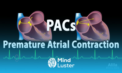 Premature Atrial Contractions PACs Animation