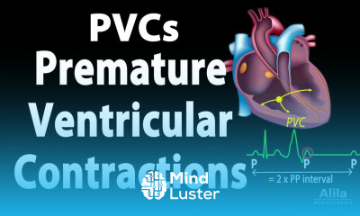 Premature Ventricular Contractions PVCs Animation