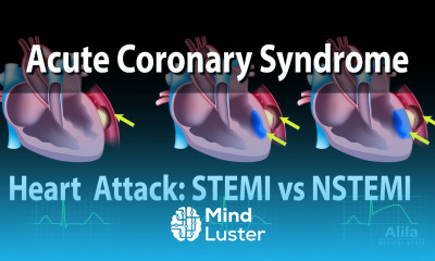 Acute Coronary Syndrome Unstable Angina NSTEMI and STEMI Heart Attack Animation