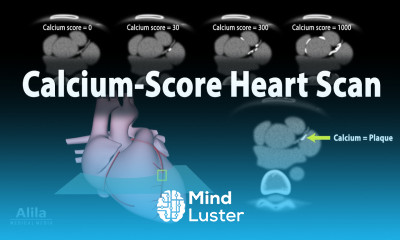 Calcium Score Heart Scan Animation