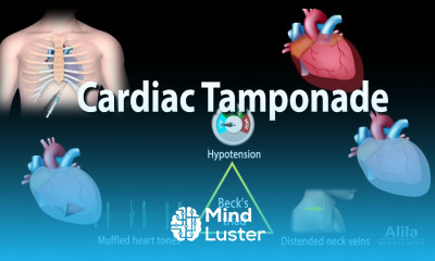 Cardiac Tamponade Pathophysiology Etiology Symptoms Diagnosis and Management Animation