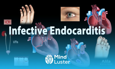 Infective Endocarditis Animation