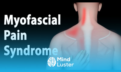 Myofascial Pain Syndrome and Trigger Points Treatments Animation