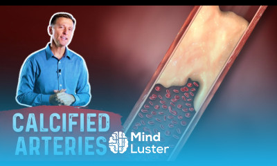 Potassium Controls Vascular Calcification