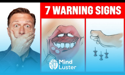 The 7 WARNING Signs of a B12 Deficiency Dr Berg