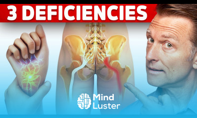 The 3 Vitamin Deficiencies in Sciatica and Carpal Tunnel Syndrome