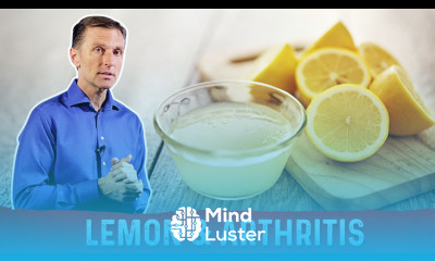 Why is Lemon Juice Good for Gout Arthritis and Bad for Osteoarthritis – Dr Berg