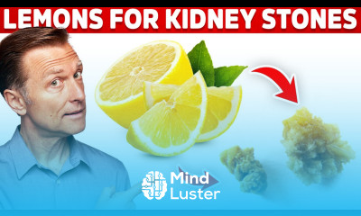 Eliminate Kidney Stones With Lemons – Kidney Stone Causes Lemon Benefits – Dr Berg
