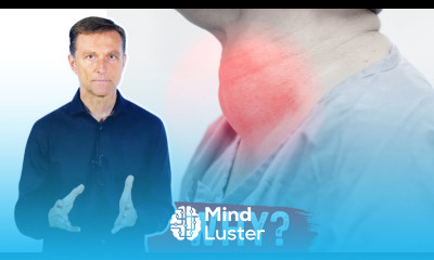 What Causes a Goiter Iodine Deficiency Thyroid Nodules – Dr Berg