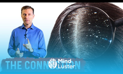 Use Probiotics for Dandruff