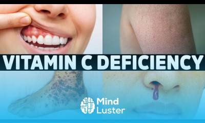 The 7 Signs You re Not Getting Enough Vitamin C