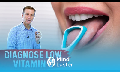 The Tongue Can Determine a Vitamin C Deficiency
