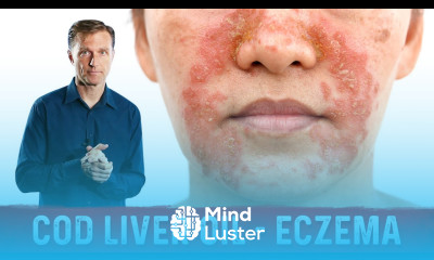 Why Use Cod Liver Oil for Eczema Remedies for Eczema – Dr Berg