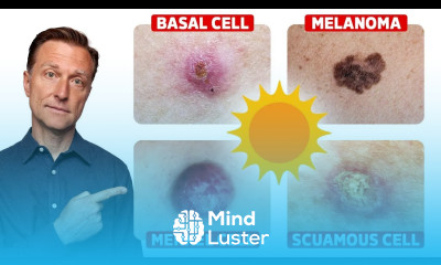 Getting Vitamin D from the Sun WITHOUT the Skin Cancer