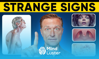 23 WEIRD Vitamin D Deficiency Symptoms