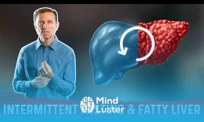 Can Intermittent Fasting Reverse a Fatty Liver Fasting as Remedy for Fatty Liver – Dr Berg
