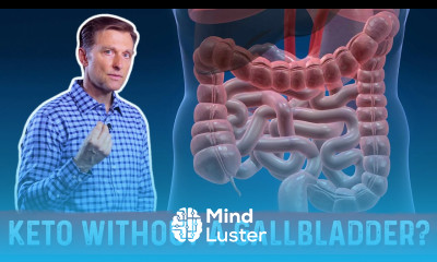 Can I do a Ketogenic Diet Without a Gallbladder – Dr Berg on Keto Diet Without Gallbladder