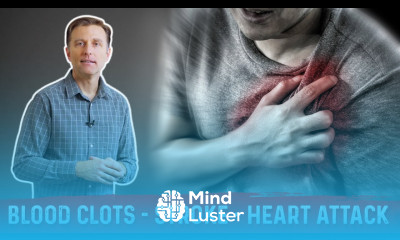 How to Prevent Blood Clots Strokes Heart Attacks – Tips by Dr Berg