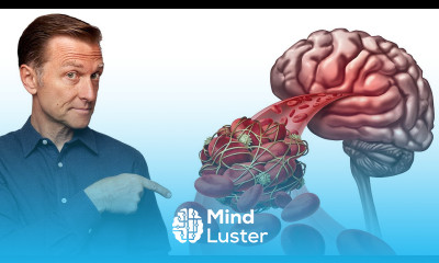 Find Out How to Predict a Silent Stroke When There Are NO SYMPTOMS Present