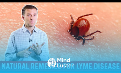 Lyme Disease Natural Remedies and Treatment – Dr Berg