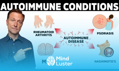 7 Surprising Causes of Autoimmune Diseases They Never Told You About