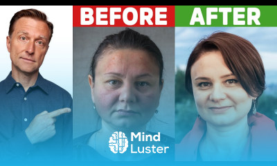 How to Put Your Autoimmune Disease In Remission