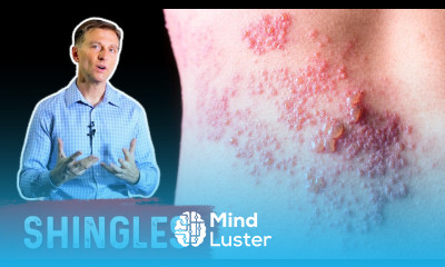 Why Is Everyone Getting Shingles