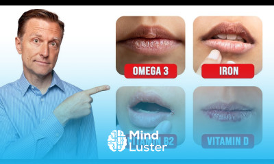 5 Things Your LIPS Can Tell You about Your Nutritional State