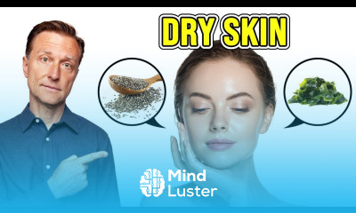 The BEST Homemade Moisturizer for Dry Skin