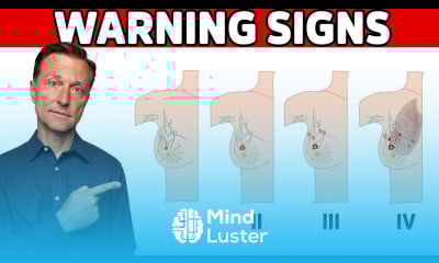 6 Early Warning Signs of Breast Cancer