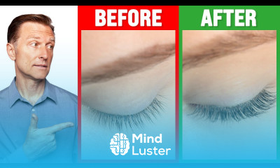 How to Grow Long Thick Eyelashes QUICKLY Dr Berg