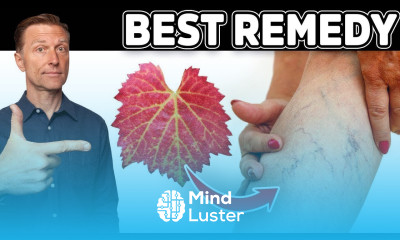 Venous Insufficiency This is the Most Effective and Safest Remedy for Varicose Veins