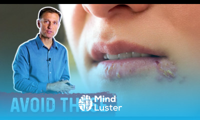 Avoid These Foods If You Have Herpes