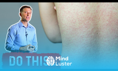 Allergic to Water Aquagenic Pruritus DO THIS