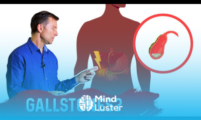 Gallbladder Problems and Prolonged Fasting