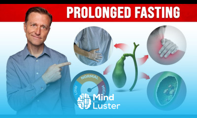 Gallbladder Biliary Sludge in Prolonged Fasting