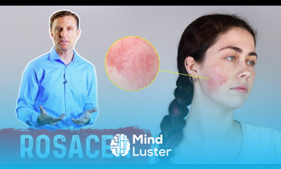 What Can Be Done for Rosacea