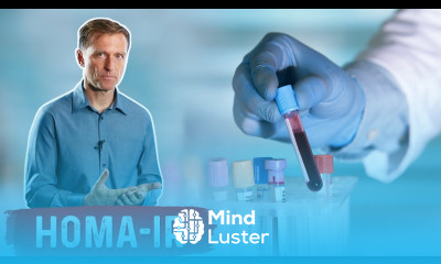 How to Test for Insulin Resistance