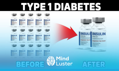 Type 1 Diabetics MUST Do This to Reduce Insulin