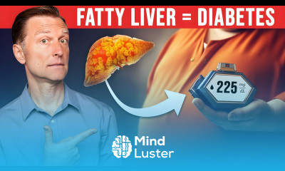 Revealing the Shocking Connection Fatty Liver and Diabetes