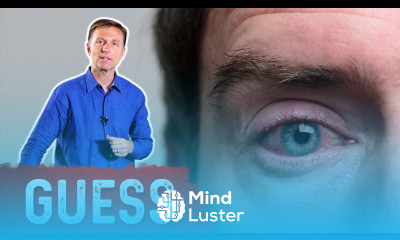 What Causes Bloodshot Eyes – Dr Berg