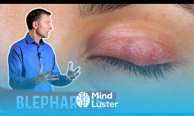 For Inflamed Eyelids Do This