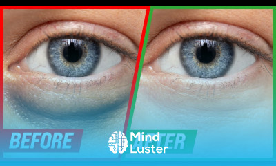 How to Get Rid of Puffy Eyes and Dark Circles