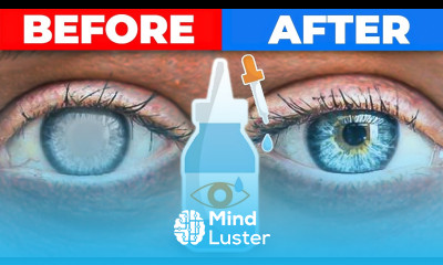 The 1 Remedy for Cataracts