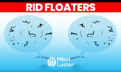 Eye Floaters What Are They How to Get Rid of Them