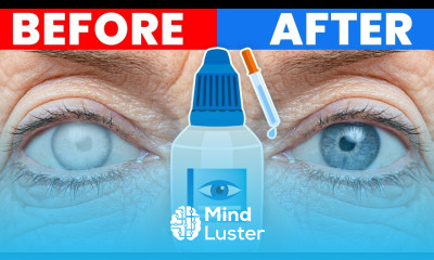 The 1 Ultimate Cure for Cataracts Dr Berg Explains